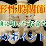 変形性股関節症