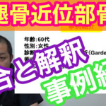 大腿骨近位部骨折